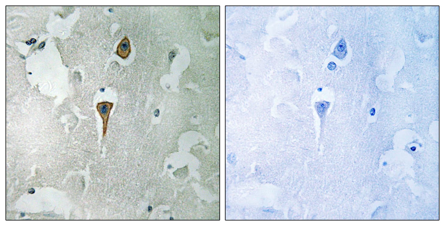 Polyclonal Rabbit anti-Human GRIN1 / NMDAR1 Antibody (aa856-905, IHC, IF, WB)