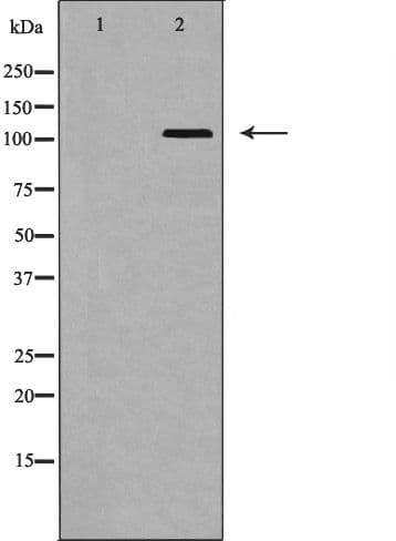 EPHA5 / EPH Receptor A5 Antibody