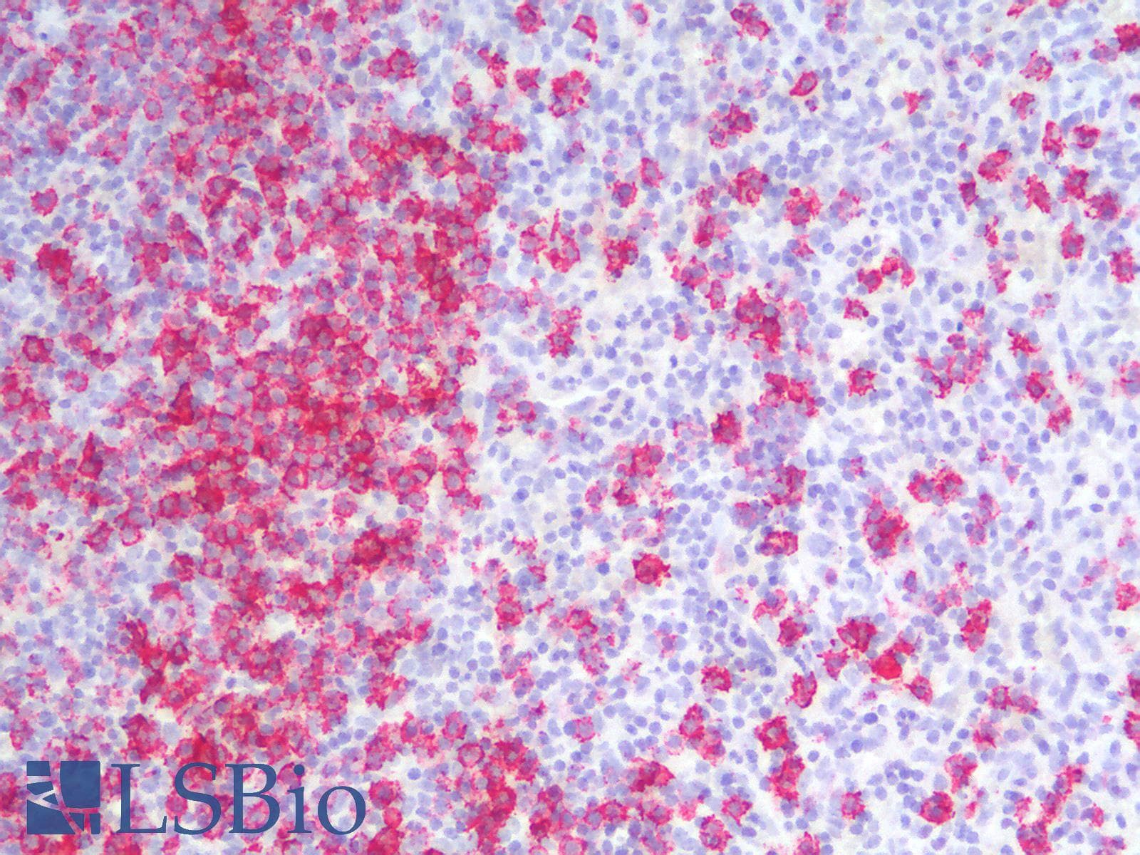 PathPlus™ CD20 Antibody (clone rIGEL/773)
