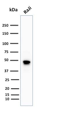 PathPlus™ CD79A / CD79 Alpha Antibody (aa202-216, clone IGA/1688R)