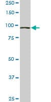 Monoclonal Mouse anti-Human VPS18 Antibody (clone 4F8, WB)