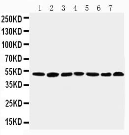 CTBP1 / CTBP Antibody (aa425-440)