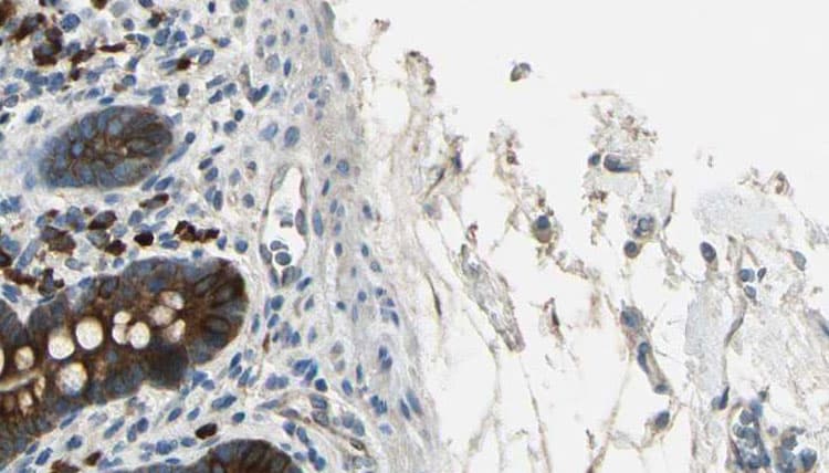 CML / BCR Antibody (phospho-Tyr360)
