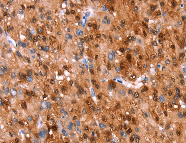 Polyclonal Rabbit anti-Human GH / Growth Hormone Antibody (IHC, WB)