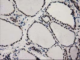 PYCRL Antibody (clone OTI3B9)