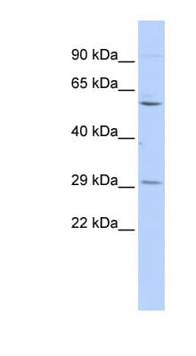 TRIM62 Antibody (C-Terminus)