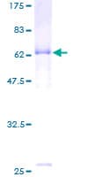 Human HAPLN1 Protein (Recombinant GST)