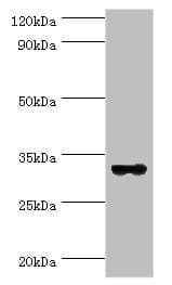 STX11 / Syntaxin 11 Antibody (aa1-287)