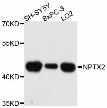 NPTX2 Antibody
