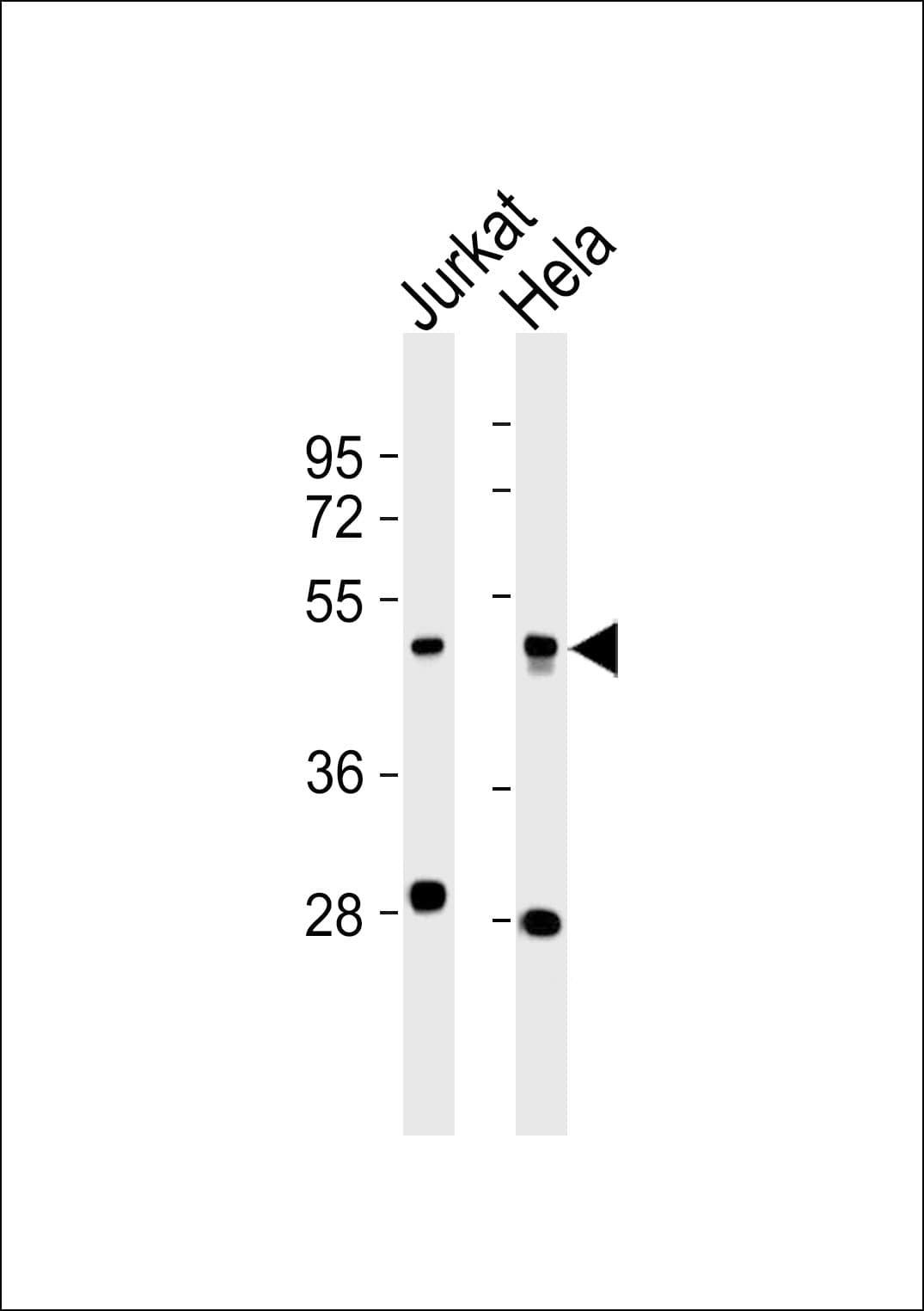 ACTR3 Antibody