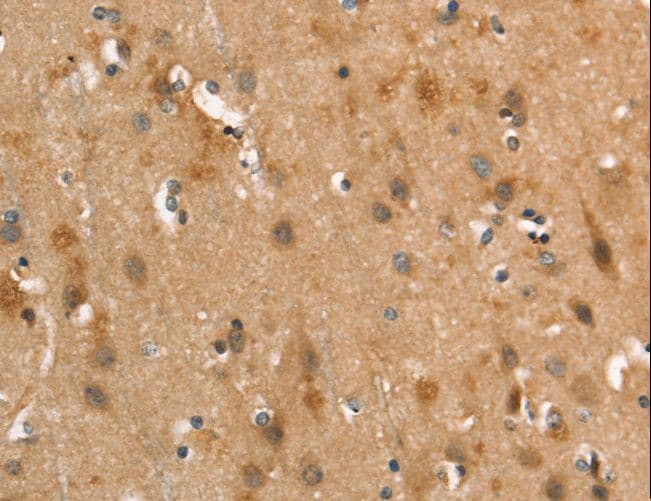 CALCRL / CGRP Receptor Antibody