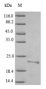 Yersinia pestis caf1 / F1 Capsule Antigen Protein (Recombinant 6His, N-terminus)