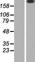 LAMB2 / Laminin Beta 2 Protein (Over-Expression Lysate Myc-DDK (Flag))