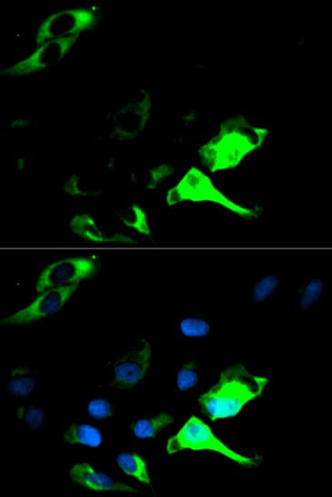 KRT8 / CK8 / Cytokeratin 8 Antibody