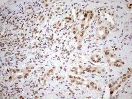 MGMT Antibody (clone OTI4F9)