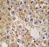 IHC-plus™ M6PR Antibody (aa35-63)