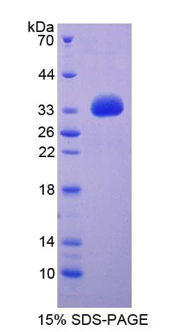 Rat SLC27A1 / FATP Protein (Recombinant His-T7)