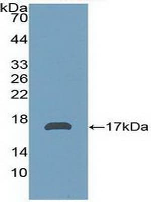 AZGP1 / ZAG Antibody (aa180-298)