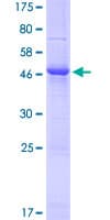 Human KLK4 / Kallikrein 4 Protein (Recombinant GST)
