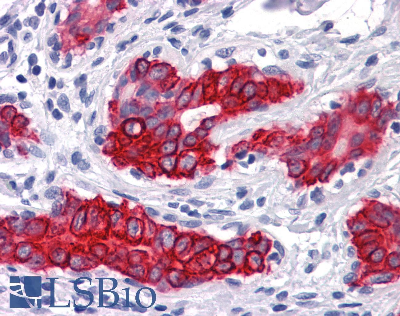 IHC-plus™ KRT15 / CK15 / Cytokeratin 15 Antibody (clone 6E7)