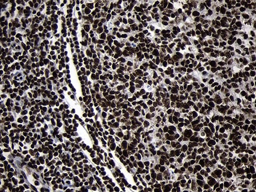 Monoclonal Mouse anti-Human HOXC4 Antibody (clone OTI1F6, IHC, WB)