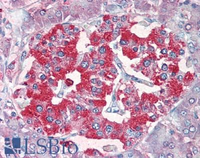 IHC-plus™ SLC18A2 / VMAT2 Antibody (C-Terminus)