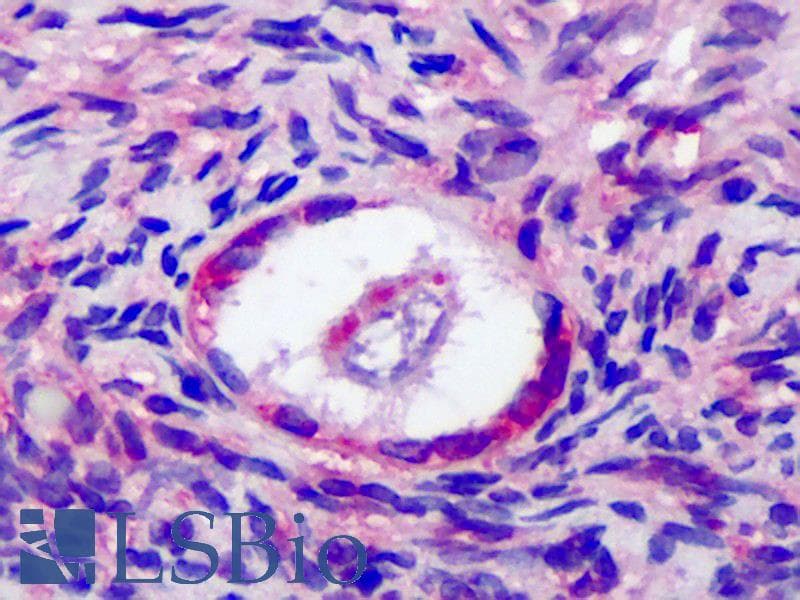 IHC-plus™ FSH Receptor / FSHR Antibody (aa278-327)