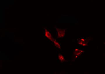 Polyclonal Rabbit anti-Human TBC1D3 / TBC1D3A Antibody (IF, WB)