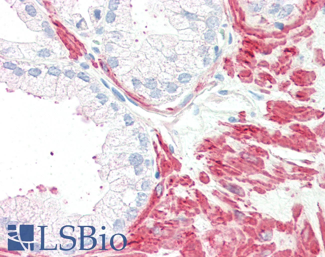 IHC-plus™ Polyclonal Rabbit anti-Human MC5R / MC5 Receptor Antibody (Internal, IHC)