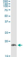 STMN1 / Stathmin / LAG Antibody (clone 3A9)