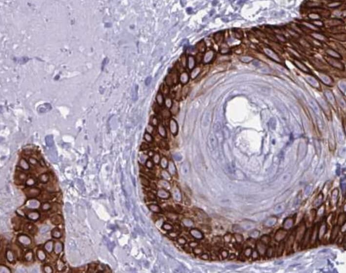 KRT19 / CK19 / Cytokeratin 19 Antibody