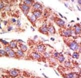USP12 Antibody (aa5-35)