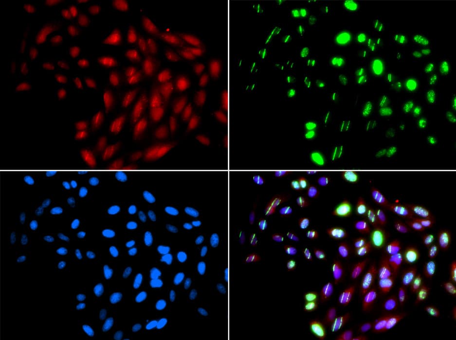 RAD51B Antibody