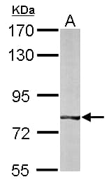 IHC-plus™ Polyclonal Rabbit anti-Human BBS7 Antibody (aa263-540, IHC, WB)