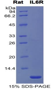 Rat IL6R / IL6 Receptor Protein (Recombinant His)