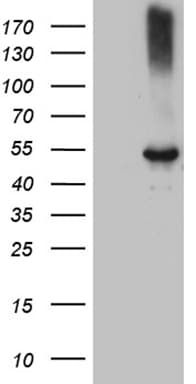Monoclonal Mouse anti-Human CLP1 Antibody (clone OTI1H7, aa1-226, WB)
