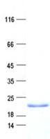 Human PPIAL4D Protein (Recombinant His, N-Terminal)