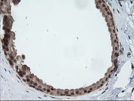 HCFC2 Antibody (clone OTI5H9)
