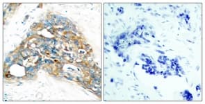 Polyclonal Rabbit anti-Human PTEN Antibody (C-Terminus, IHC, WB)