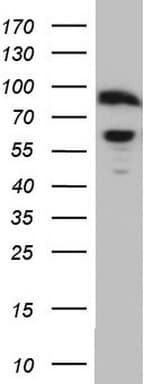 Polyclonal Rabbit anti-Human RELA / NFKB p65 Antibody (aa100-170, IHC, WB)