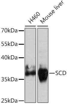 SCD1 / SCD Antibody