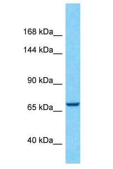 CCDC180 / C9orf174 Antibody (aa112-161)
