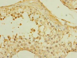 Polyclonal Rabbit anti-Human SLCO2B1 Antibody (IHC)