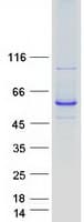 Human CYP2C8 Protein (Recombinant Myc-DDK (Flag))