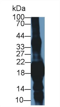 CRYGS Antibody (aa2-178, PE)
