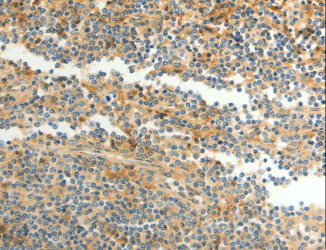 CFHR1 Antibody