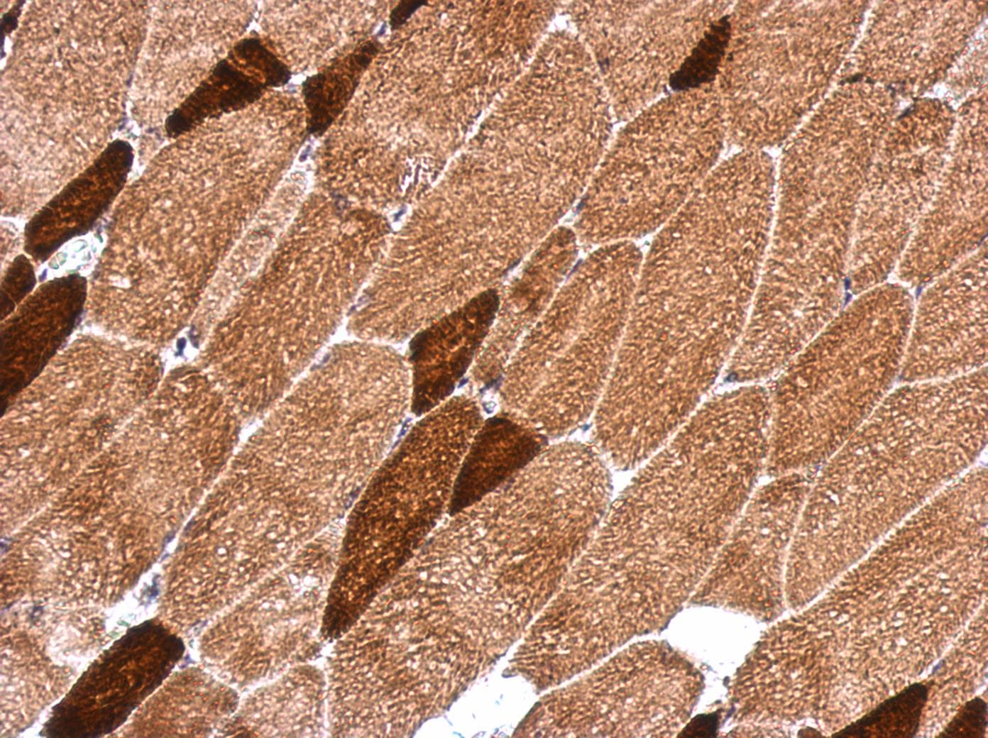 OXSM / KS Antibody