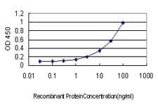 TOP2A / Topoisomerase II Alpha Antibody (clone 1E2)