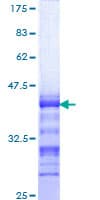 Human FOXP2 Protein (Recombinant GST, N-terminus)