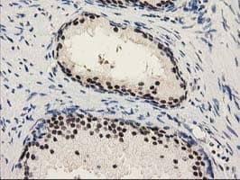 PYCRL Antibody (clone OTI8H6)